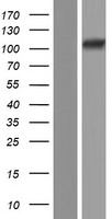 TXNDC11 Protein - Western validation with an anti-DDK antibody * L: Control HEK293 lysate R: Over-expression lysate