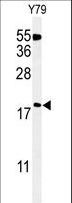TXNDC12 Antibody - Western blot of TXNDC12 Antibody in Y79 cell line lysates (35 ug/lane). TXNDC12 (arrow) was detected using the purified antibody.