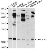 TXNDC12 Antibody - Western blot analysis of extracts of various cell lines, using TXNDC12 antibody at 1:3000 dilution. The secondary antibody used was an HRP Goat Anti-Rabbit IgG (H+L) at 1:10000 dilution. Lysates were loaded 25ug per lane and 3% nonfat dry milk in TBST was used for blocking. An ECL Kit was used for detection and the exposure time was 90s.