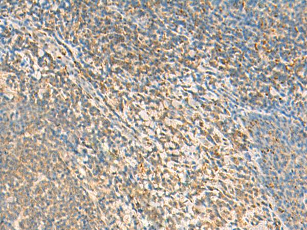 TXNDC12 Antibody - Immunohistochemistry of paraffin-embedded Human tonsil tissue  using TXNDC12 Polyclonal Antibody at dilution of 1:50(×200)