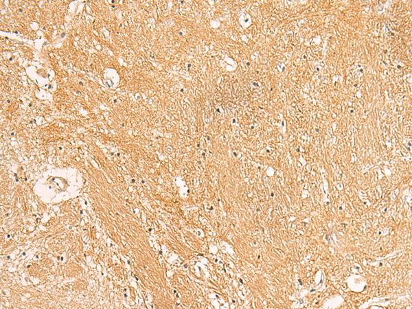 TXNDC12 Antibody - Immunohistochemistry of paraffin-embedded Human brain tissue  using TXNDC12 Polyclonal Antibody at dilution of 1:50(×200)