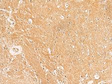 TXNDC12 Antibody - Immunohistochemistry of paraffin-embedded Human brain tissue  using TXNDC12 Polyclonal Antibody at dilution of 1:50(×200)
