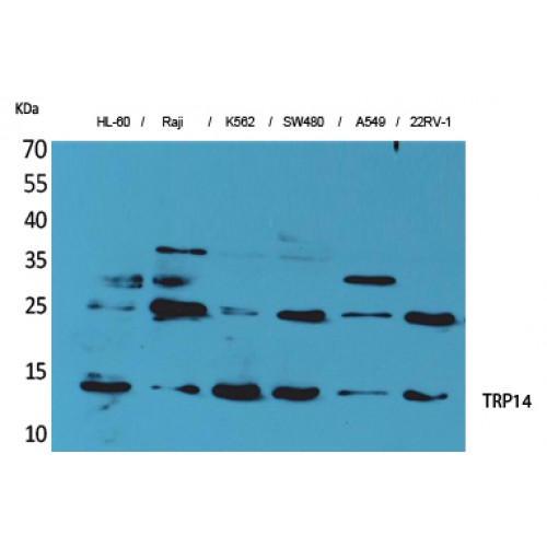 TXNDC17 Antibody - Western blot of TRP14 antibody