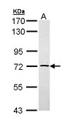 TXNDC3 Antibody - Sample (30 ug of whole cell lysate). A: Raji. 7.5% SDS PAGE. TXNDC3 antibody diluted at 1:1000.