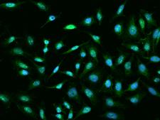 TXNDC3 Antibody - Immunofluorescence staining of TXNDC3 in HeLa cells. Cells were fixed with 4% PFA, permeabilzed with 0.3% Triton X-100 in PBS, blocked with 10% serum, and incubated with rabbit anti-Human TXNDC3 polyclonal antibody (dilution ratio 1:200) at 4°C overnight. Then cells were stained with the Alexa Fluor 488-conjugated Goat Anti-rabbit IgG secondary antibody (green) and counterstained with DAPI (blue). Positive staining was localized to Nucleus and Cytoplasm.