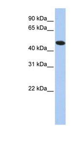 TXNDC5 / ERP46 Antibody - TXNDC5 antibody Western blot of HepG2 cell lysate. This image was taken for the unconjugated form of this product. Other forms have not been tested.