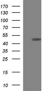 TXNDC5 / ERP46 Antibody - HEK293T cells were transfected with the pCMV6-ENTRY control (Left lane) or pCMV6-ENTRY TXNDC5 (Right lane) cDNA for 48 hrs and lysed. Equivalent amounts of cell lysates (5 ug per lane) were separated by SDS-PAGE and immunoblotted with anti-TXNDC5.