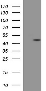 TXNDC5 / ERP46 Antibody - HEK293T cells were transfected with the pCMV6-ENTRY control (Left lane) or pCMV6-ENTRY TXNDC5 (Right lane) cDNA for 48 hrs and lysed. Equivalent amounts of cell lysates (5 ug per lane) were separated by SDS-PAGE and immunoblotted with anti-TXNDC5.