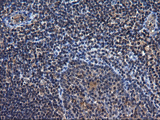 TXNDC5 / ERP46 Antibody - IHC of paraffin-embedded Human lymph node tissue using anti-TXNDC5 mouse monoclonal antibody. (Heat-induced epitope retrieval by 1 mM EDTA in 10mM Tris, pH8.5, 120°C for 3min).