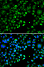 TXNDC5 / ERP46 Antibody - Immunofluorescence analysis of MCF7 cells.