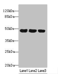 TXNDC5 / ERP46 Antibody - Western blot All Lanes: TXNDC5 antibody at 4.9ug/ml Lane 1: HepG-2 whole cell lysate Lane 2: Colo320 whole cell lysate Lane 3: Mouse stomach tissue Secondary Goat polyclonal to Rabbit IgG at 1/10000 dilution Predicted band size: 48,37 kDa Observed band size: 48 kDa