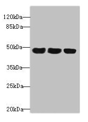 TXNDC5 / ERP46 Antibody - Western blot All lanes: TXNDC5 antibody at 4.9µg/ml Lane 1: HepG2 whole cell lysate Lane 2: Colo320 whole cell lysate Lane 3: Mouse stomach tissue Secondary Goat polyclonal to rabbit IgG at 1/10000 dilution Predicted band size: 48, 37 kDa Observed band size: 48 kDa