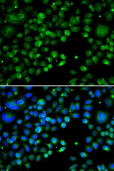 TXNDC5 / ERP46 Antibody - Immunofluorescence analysis of MCF-7 cells using TXNDC5 antibody. Blue: DAPI for nuclear staining.