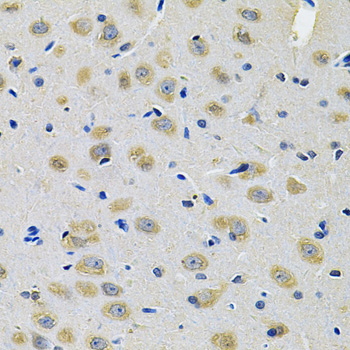TXNDC5 / ERP46 Antibody - Immunohistochemistry of paraffin-embedded rat brain using TXNDC5 Antibody at dilution of 1:100 (40x lens).