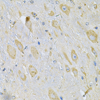TXNDC5 / ERP46 Antibody - Immunohistochemistry of paraffin-embedded mouse brain using TXNDC5 Antibody at dilution of 1:100 (40x lens).
