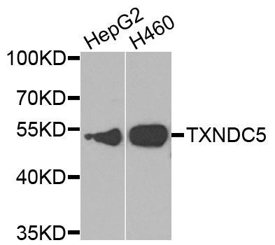 TXNDC5 / ERP46 Antibody - Western blot analysis of extracts of various cell lines, using TXNDC5 antibody at 1:1000 dilution. The secondary antibody used was an HRP Goat Anti-Rabbit IgG (H+L) at 1:10000 dilution. Lysates were loaded 25ug per lane and 3% nonfat dry milk in TBST was used for blocking. An ECL Kit was used for detection and the exposure time was 90s.