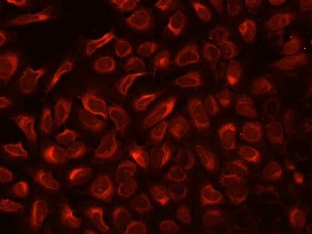 TXNDC5 / ERP46 Antibody - Immunofluorescence staining of TXNDC5 in U2OS cells. Cells were fixed with 4% PFA, permeabilzed with 0.1% Triton X-100 in PBS, blocked with 10% serum, and incubated with rabbit anti-Human TXNDC5 polyclonal antibody (dilution ratio 1:200) at 4°C overnight. Then cells were stained with the Alexa Fluor 594-conjugated Goat Anti-rabbit IgG secondary antibody (red). Positive staining was localized to Cytoplasm.