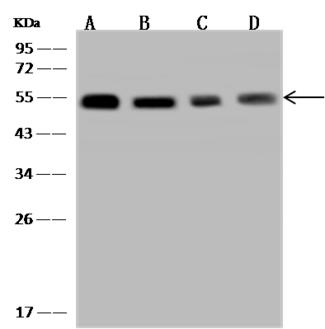 TXNDC5 / ERP46 Antibody - Anti-TXNDC5 rabbit polyclonal antibody at 1:5000 dilution. Lane A: HepG2 Whole Cell Lysate. Lane B: HeLa Whole Cell Lysate. Lane C: HEK293 Whole Cell Lysate. Lane D: 293T Whole Cell Lysate. Lysates/proteins at 30 ug per lane. Secondary: Goat Anti-Rabbit IgG (H+L)/HRP at 1/10000 dilution. Developed using the ECL technique. Performed under reducing conditions. Predicted band size: 48 kDa. Observed band size: 50 kDa.