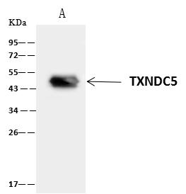 TXNDC5 / ERP46 Antibody - TXNDC5 was immunoprecipitated using: Lane A: 0.5 mg HepG2 Whole Cell Lysate. 4 uL anti-TXNDC5 rabbit polyclonal antibody and 60 ug of Immunomagnetic beads Protein A/G. Primary antibody: Anti-TXNDC5 rabbit polyclonal antibody, at 1:100 dilution. Secondary antibody: Clean-Blot IP Detection Reagent (HRP) at 1:1000 dilution. Developed using the ECL technique. Performed under reducing conditions. Predicted band size: 48 kDa. Observed band size: 50 kDa.