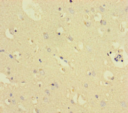 TXNDC8 Antibody - Immunohistochemistry of paraffin-embedded human brain tissue using TXNDC8 Antibody at dilution of 1:100