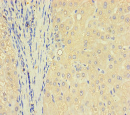 TXNDC8 Antibody - Immunohistochemistry of paraffin-embedded human liver tissue using TXNDC8 Antibody at dilution of 1:100