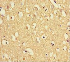 TXNDC9 Antibody - Immunohistochemistry of paraffin-embedded human brain tissue using TXNDC9 Antibody at dilution of 1:100