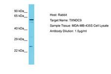 TXNDC9 Antibody -  This image was taken for the unconjugated form of this product. Other forms have not been tested.