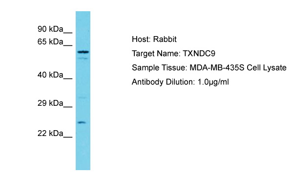 TXNDC9 Antibody -  This image was taken for the unconjugated form of this product. Other forms have not been tested.