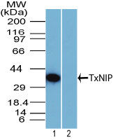 TXNIP Antibody - Western blot of TxNIP in Raji cell lysate in the 1) absence and 2) presence of immunizing peptide using Polyclonal Antibody to TxNIP at 2 ug/ml. Goat anti-rabbit Ig HRP secondary antibody, and PicoTect ECL substrate solution were used for this test.