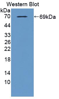 TXNIP Antibody - Western blot of TXNIP antibody.