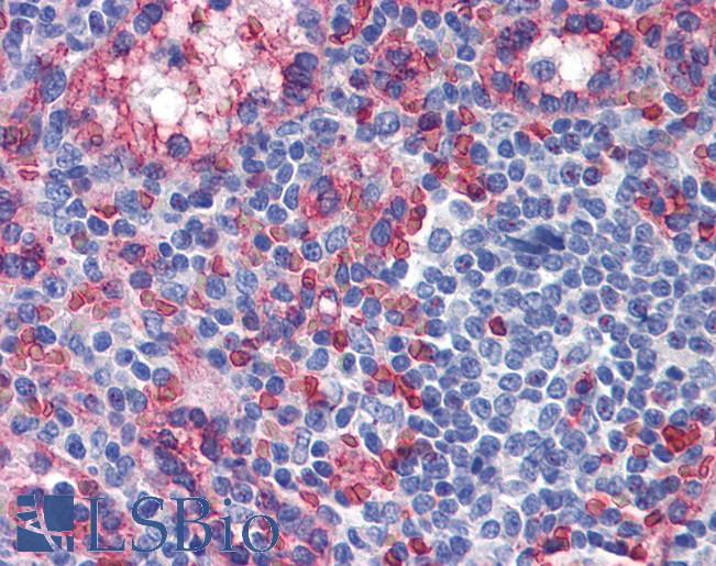 TXNIP Antibody - Anti-TXNIP antibody IHC of human spleen. Immunohistochemistry of formalin-fixed, paraffin-embedded tissue after heat-induced antigen retrieval. Antibody concentration 5 ug/ml.  This image was taken for the unconjugated form of this product. Other forms have not been tested.