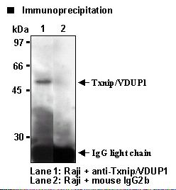 TXNIP Antibody
