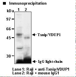 TXNIP Antibody