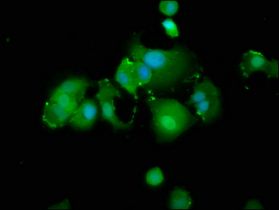 TXNIP Antibody - Immunofluorescence staining of MCF-7 cells at a dilution of 1:166, counter-stained with DAPI. The cells were fixed in 4% formaldehyde, permeabilized using 0.2% Triton X-100 and blocked in 10% normal Goat Serum. The cells were then incubated with the antibody overnight at 4 °C.The secondary antibody was Alexa Fluor 488-congugated AffiniPure Goat Anti-Rabbit IgG (H+L) .