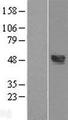 TXNIP Protein - Western validation with an anti-DDK antibody * L: Control HEK293 lysate R: Over-expression lysate