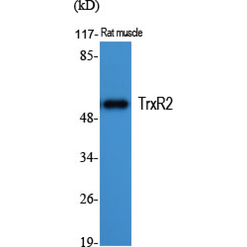 TXNRD2 Antibody - Western blot of TrxR2 antibody