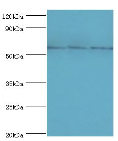 TXNRD2 Antibody - Western blot. All lanes: Thioredoxin reductase 2, mitochondrial antibody at 6 ug/ml. Lane 1: mouse liver tissue. Lane 2: mouse gonad tissue. Lane 3: HeLa whole cell lysate. secondary Goat polyclonal to rabbit at 1:10000 dilution. Predicted band size: 57 kDa. Observed band size: 57 kDa.