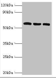 TXNRD2 Antibody - Western blot All lanes: Thioredoxin reductase 2, mitochondrial antibody at 6µg/ml Lane 1: Mouse liver tissue Lane 2: Mouse gonad tissue Lane 3: Hela whole cell lysate Secondary Goat polyclonal to rabbit IgG at 1/10000 dilution Predicted band size: 57, 54, 47, 31 kDa Observed band size: 57 kDa