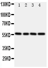 TXNRD2 Antibody - Anti-TXNRD2 antibody, Western blotting Lane 1: Rat Kidney Tissue LysateLane 2: Rat Ovary Tissue LysateLane 3: Rat Liver Tissue LysateLane 4: SMMC Cell Lysate