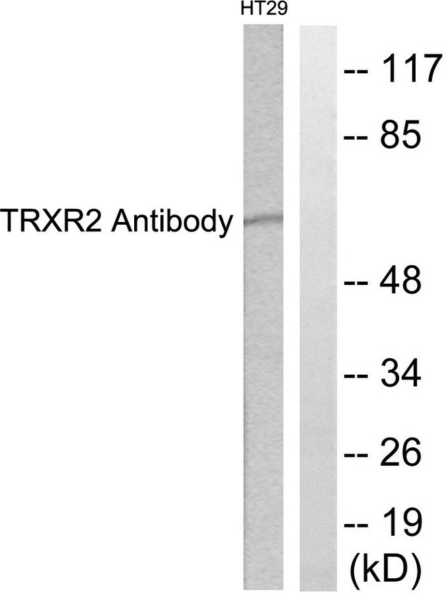 TXNRD2 Antibody - Western blot analysis of lysates from HT29 cells, using TRXR2 Antibody. The lane on the right is blocked with the synthesized peptide.