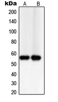 TXNRD2 Antibody - Western blot analysis of TXNRD2 expression in PC12 (A); Jurkat (B) whole cell lysates.