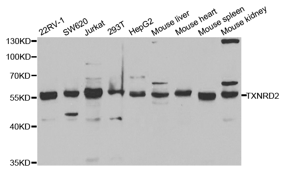 TXNRD2 Antibody - Western blot analysis of extracts of various cell lines, using TXNRD2 antibody.
