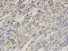 TXNRD2 Antibody - Immunohistochemistry of paraffin-embedded rat kidney using TXNRD2 antibody at dilution of 1:200 (400x lens).