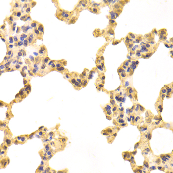 TXNRD2 Antibody - Immunohistochemistry of paraffin-embedded mouse lung tissue.