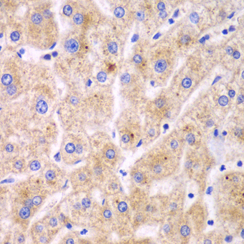 TXNRD2 Antibody - Immunohistochemistry of paraffin-embedded human liver injury tissue.