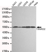 TXNRD2 Antibody - Western blot detection of TXNRD2 in A431, U251, U2OS, Lncap and HeLa cell lysates and using TXNRD2 mouse monoclonal antibody (1:1000 dilution). Predicted band size: 56KDa. Observed band size: 56KDa.