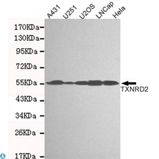 TXNRD2 Antibody - Western blot detection of TXNRD2 in A431, U251, U2OS, Lncap and Hela cell lysates and using TXNRD2 mouse mAb (1:1000 diluted). Predicted band size: 56KDa. Observed band size: 56KDa.