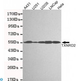 TXNRD2 Antibody - Western blot detection of TXNRD2 in A431, U251, U2OS, Lncap and Hela cell lysates and using TXNRD2 mouse mAb (1:1000 diluted). Predicted band size: 56KDa. Observed band size: 56KDa.