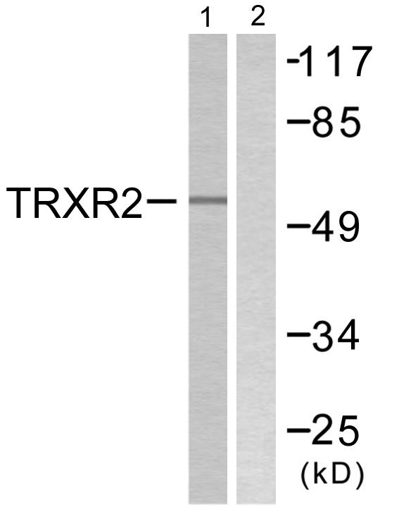 TXNRD2 Antibody - Western blot analysis of extracts from HT29 cells, using TRXR2 antibody.