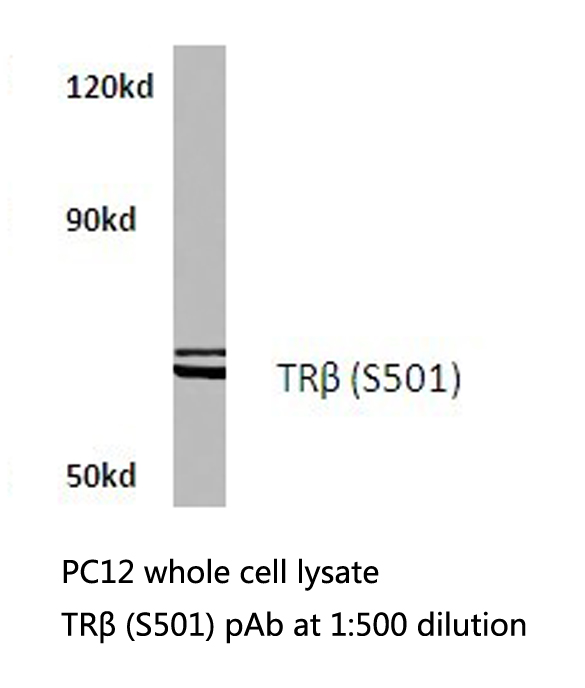 TXNRD2 Antibody - Western blot of TRXR2 (S501) pAb in extracts from PC12 cells.
